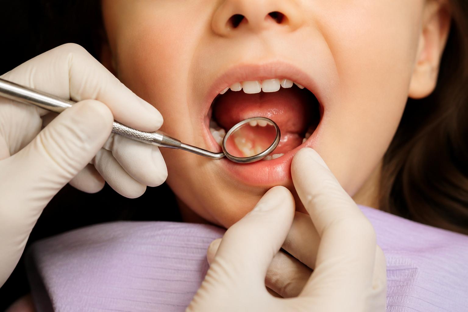 Children's dental examination of a young patient's smile